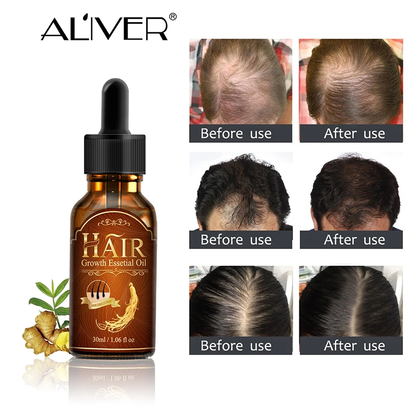 Strengthening Formula 30ml Natural Hair Loss Treatment Serum Hair ...