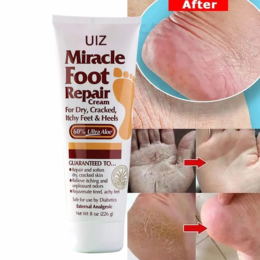 Anti Cracking Foot Cream Hydrating Cracked Heel Treatment Dead