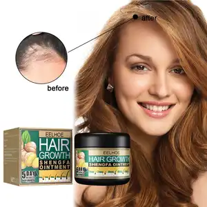 Hair Loss Treatment Solution 5 Days Ginger Hair Growth Ointment 30g Hair Growth Cream