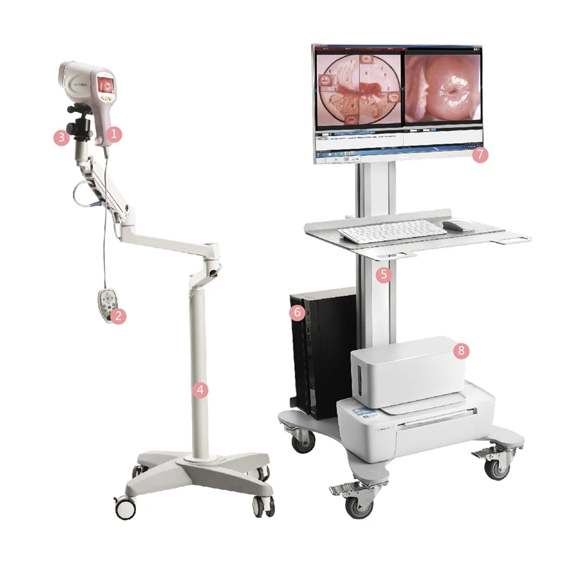 Digital Colposcope Camera for Vaginal and Rectal Use - Portable Medical ...