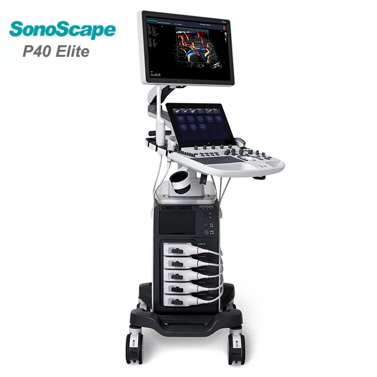 Sonoscape P40 Elite Medical Ultrasound machine - Oxyaider 
