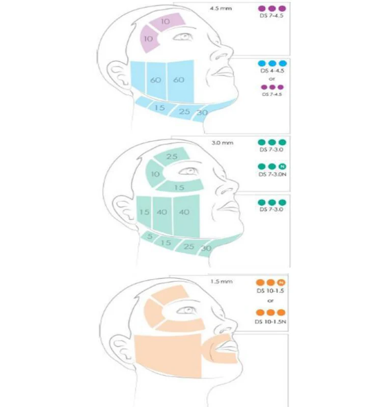 Portable 3D Anti-wrinkle Skin Tightening Ultrasound Face Lift Machine