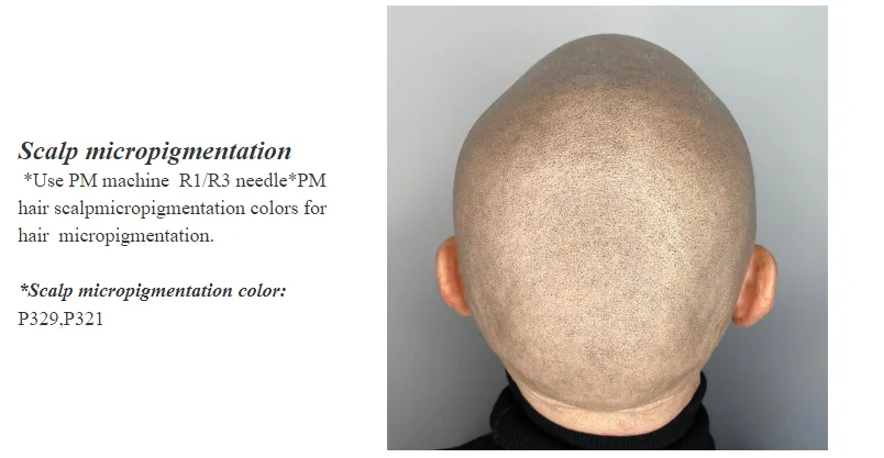 PM SCALP