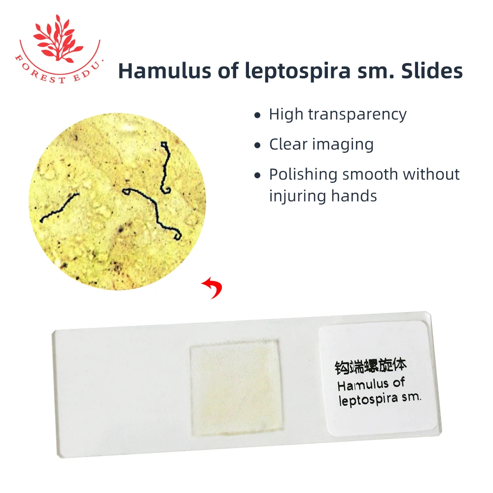 Spirochetes Bacteria Leptospira Hook Medical Microbiological Etiology ...