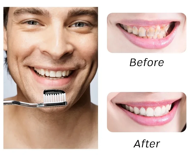 Toothpaste Smokers Stain Removal Gums Bleeding Smokers Teeth Whitening