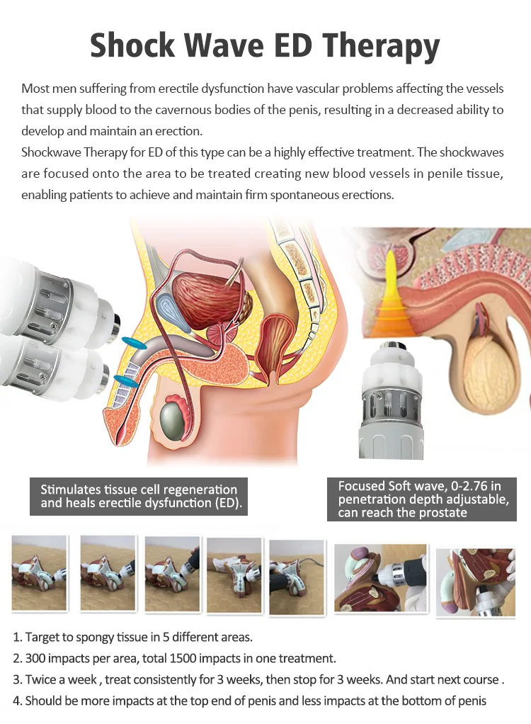 Factory Direct Portable SWT Physio Shockwave Therapy Device Aluminum Case Compact Design for Muscle Bone Healing Sports Injury