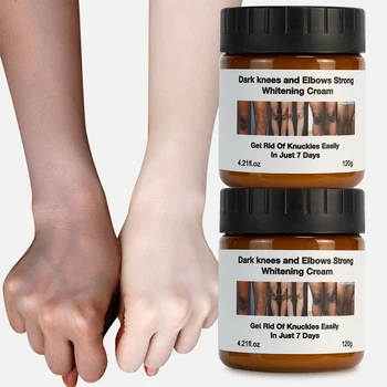 Private Label Extreme Anti Dark Spot Wrinkle Knees Elbows Vitamin Body Care White Lotion Moisturizer Face Body Whitening Cream