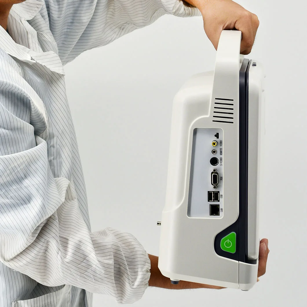 Portable PC Platform Color Full Digital Ultra Sound Scan Portable Laptop Ultrasound Machine