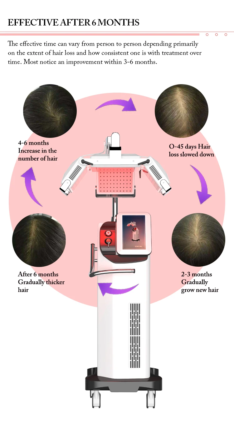 GOMECY-health-660nm-diode-laseR-hair-grow-anti-hair-loss-promote-hair-grown-fastly-machine