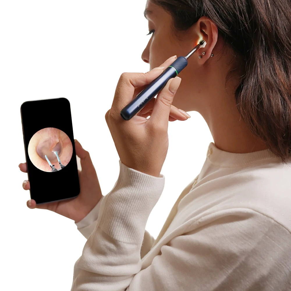 Bebird Note 5 Pro Smart Visual Robotic Arm Ear Wax Removal Endoscope Camera Rechargeable Visible Ear Wax Cleaner