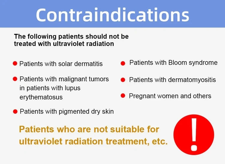 Uvb Lamp Uv Lamp Phototherapy Light Therapy Psoriasis 311nm Uvb Light Therapy Vitiligo Cream Treatment