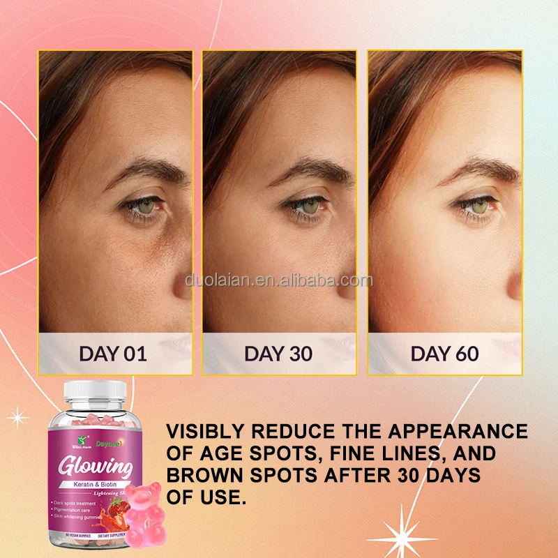 glutathione skin whitening gummies Purna Cola Flavor Gummies For and Immune Booster- 30 Gummies Glow Up with Skin Whitening