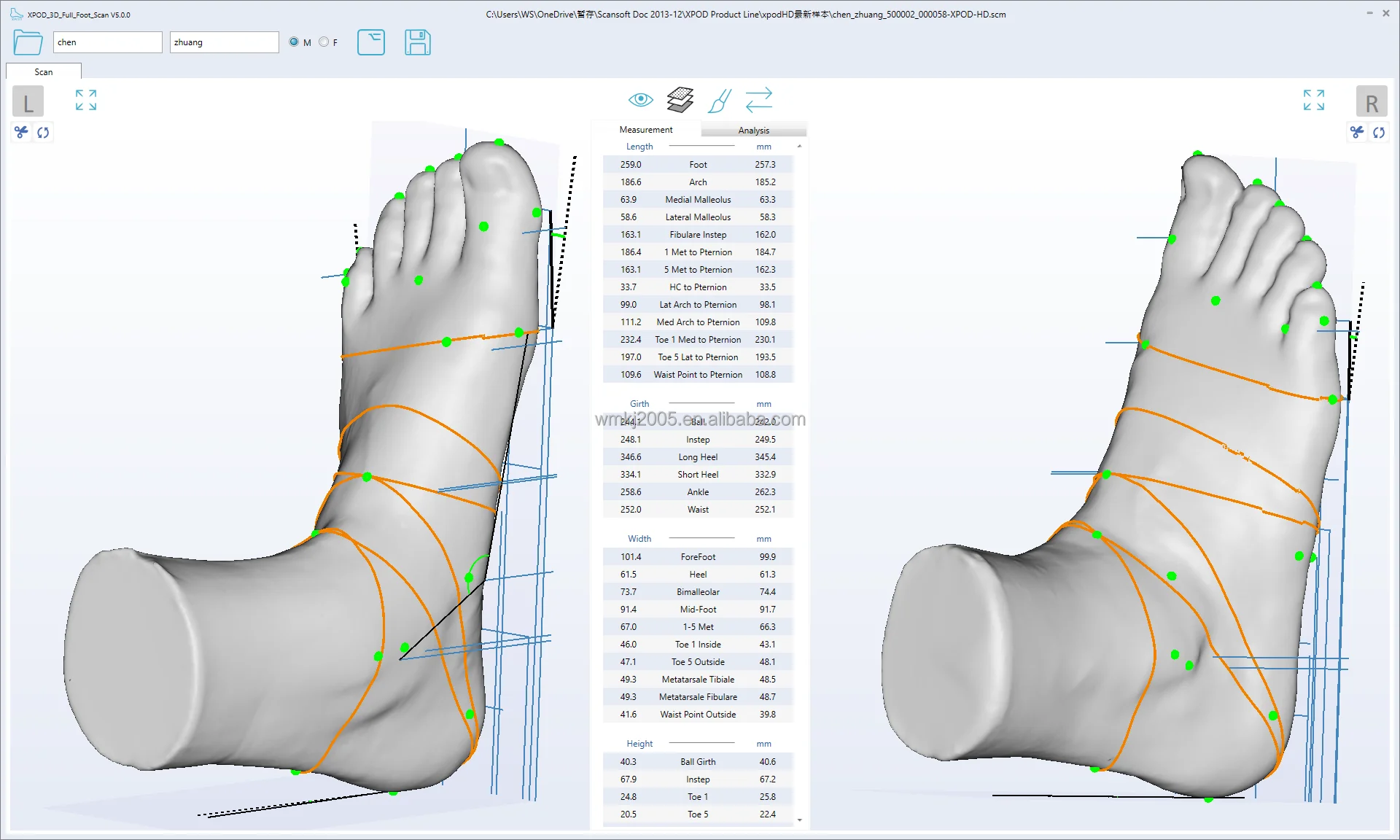 Vismach XPOD-HD Foot Scanner - Customized Orthotic Support