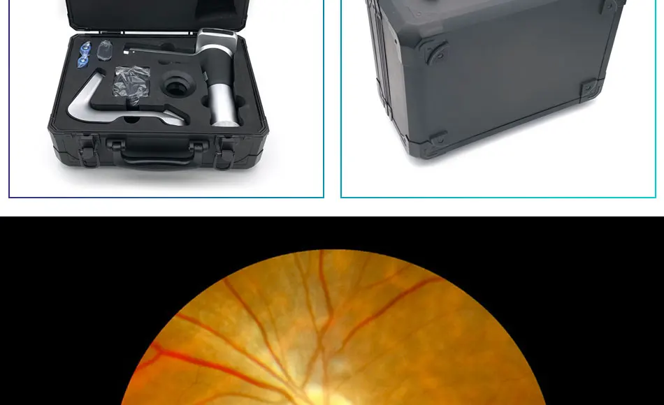 Rightway Brand  High Quality Automatic Portable Handheld Digital Eye Fundus Camera HFC-2