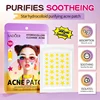 Star-shaped pimple patch