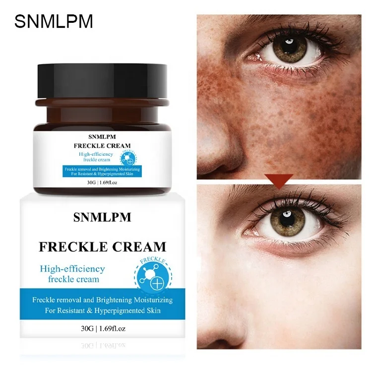 SNMLPM Freckle Removing Cream  30ml Private Label Face Whitening Cream Fade Dark Spot Freckle Face Cream