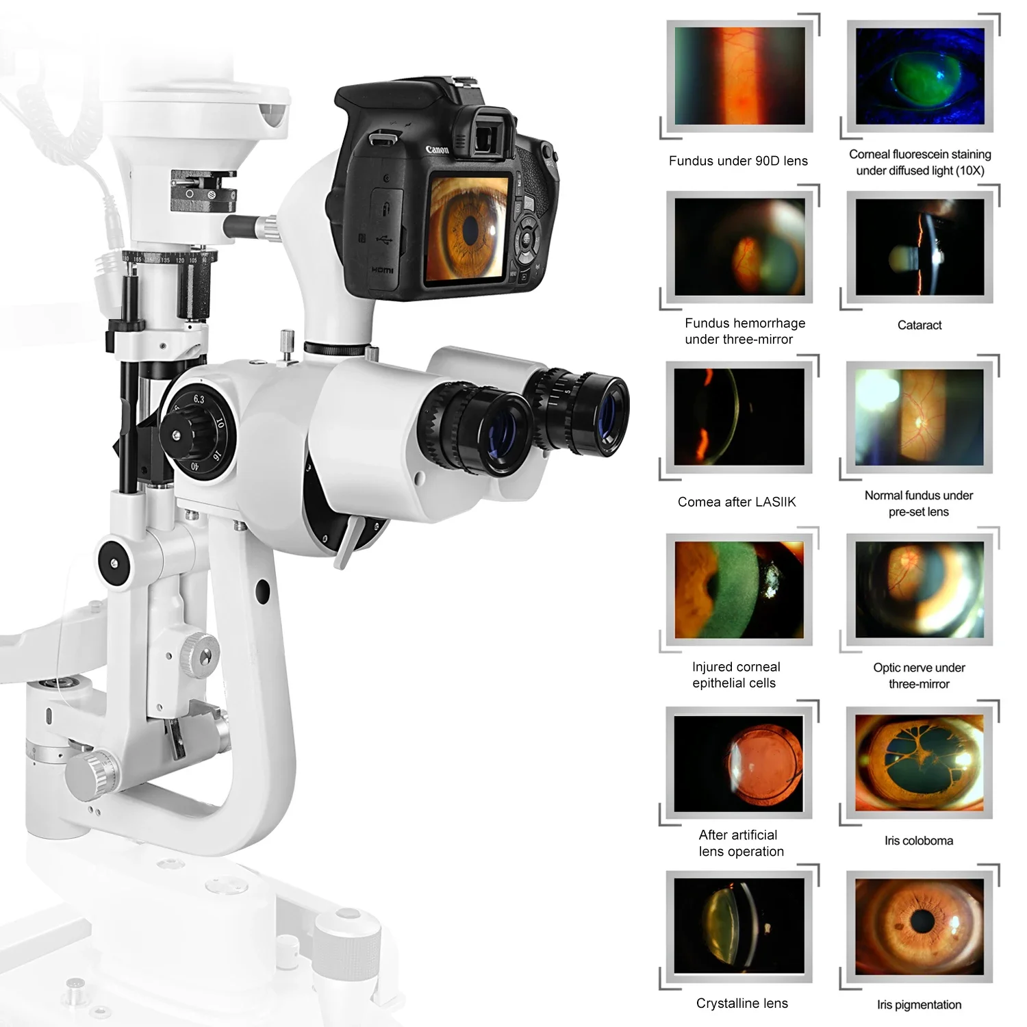 Digital Optical Slit Lamp Ophthalmic Equipment High Quality Ophthalmic Eye Examination Equipment Digital Slit Lamp LS-5DX