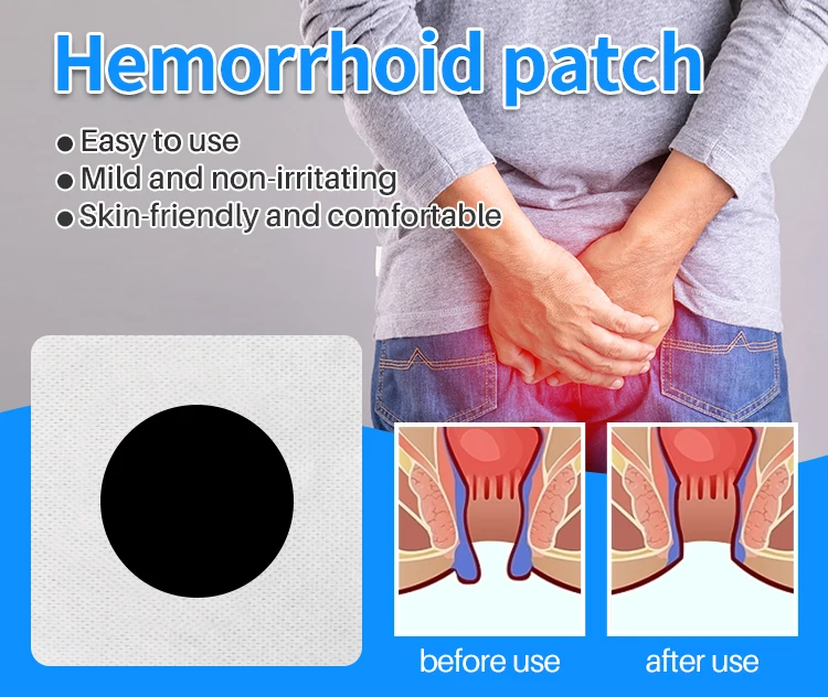 Internal External Hemorrhoid Removal Ointment Patch Hemorrhoids Plaster ...