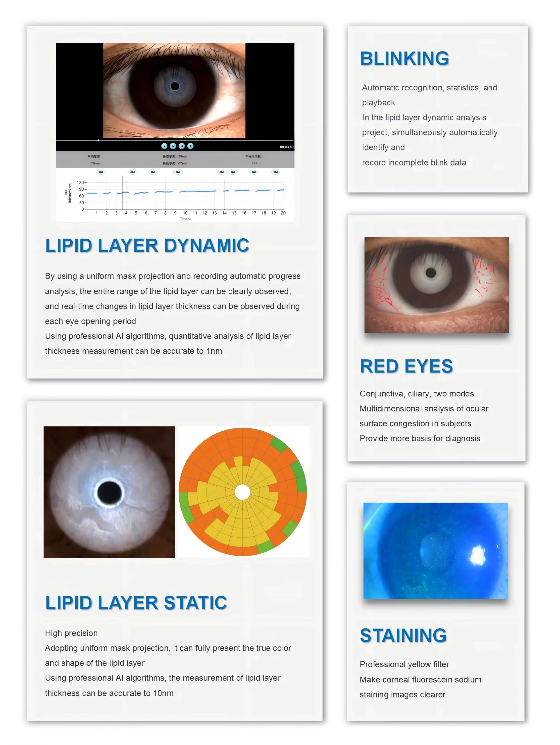 Dry Eye Examination Ocular Surface Analyzer Dry Eye Analyzer Ophthalmic Equipment
