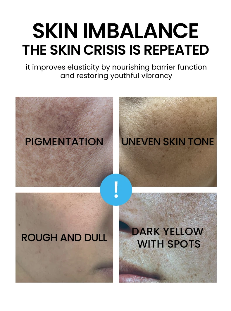 Wholesale Original Milk Essence Moisturizing Brightening Wrinkle Relieving Face Lotion(pic2)