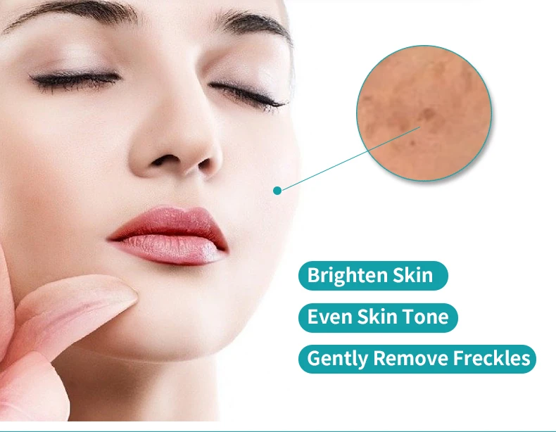 Quick Anti Freckles Deep Moisturizing Strong Bleaching Whitening Face