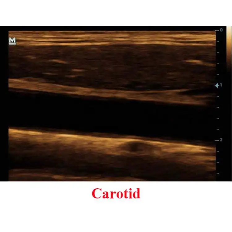 Mindray DP-20 Medical Full Digital Ultrasound Scanner Price 3d 4d Portable Ultrasound Machine