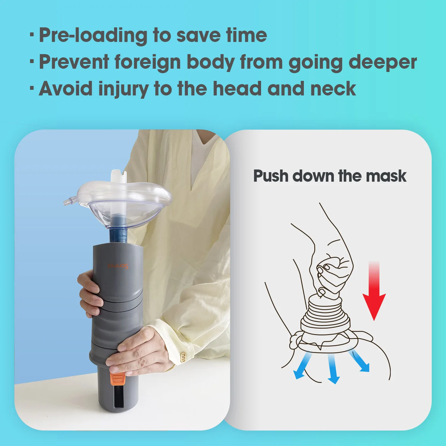 Sonmol Automatic Choking Rescue Anti Choking Device Aiway Throat Obstruction Blockage Removal Manual Suction Emergency