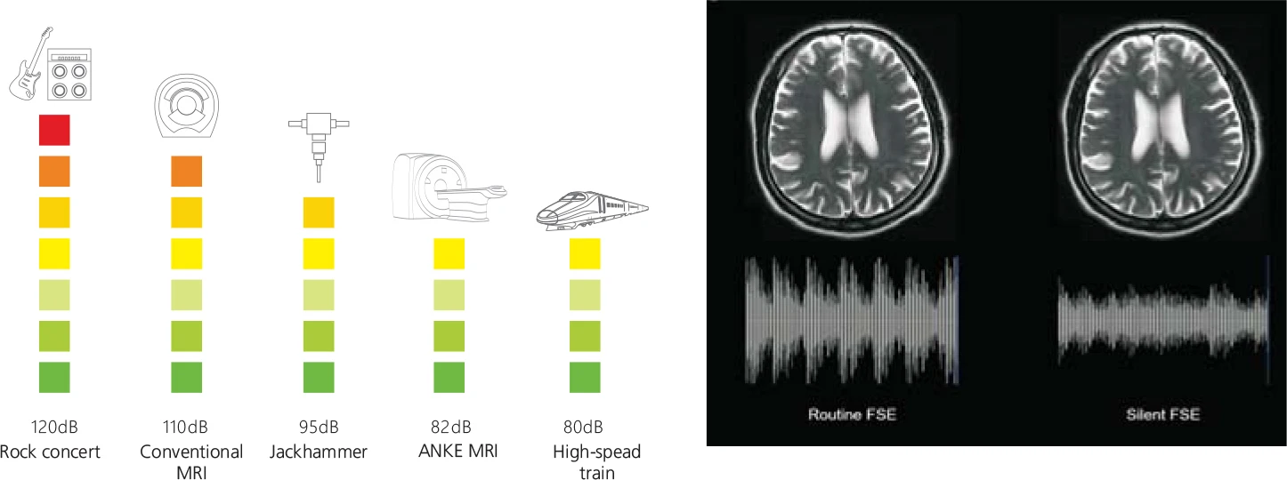 Hospital Medical Magnetic Resonance Imaging System 1.5T  MRI Machine with A-combi and Al Technologies details