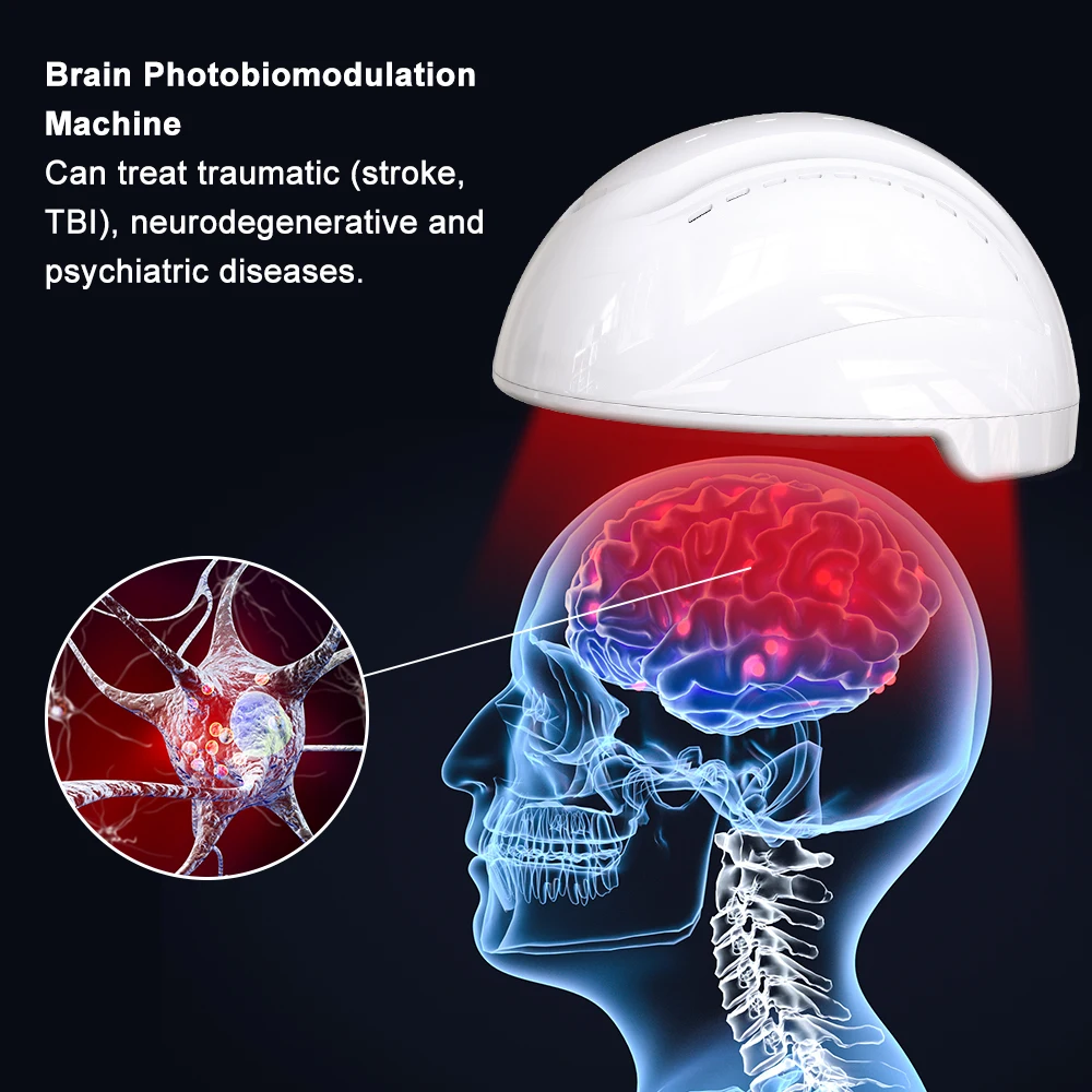 Casque Thérapie Laser 810nm Pour Photobiomodulation - Parkinson, AVC, Dépression - 280 LEDs