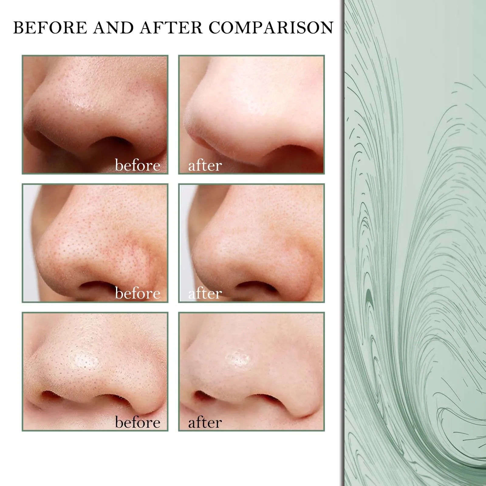 Youtube Deep Blackheads 87 - 1wk4bot