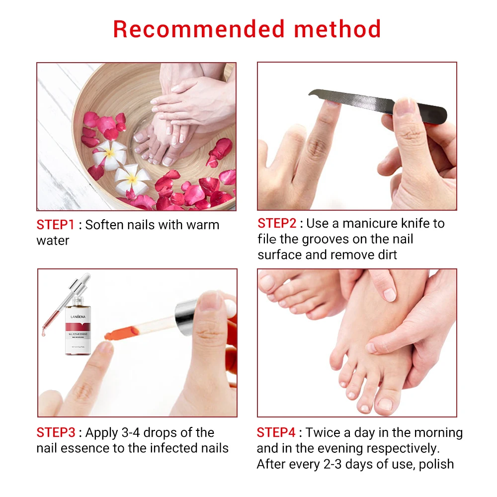 LANBENA Hot Sale Nail Essence Anti Fungus Nail Care Nourish Repair Serum supplier
