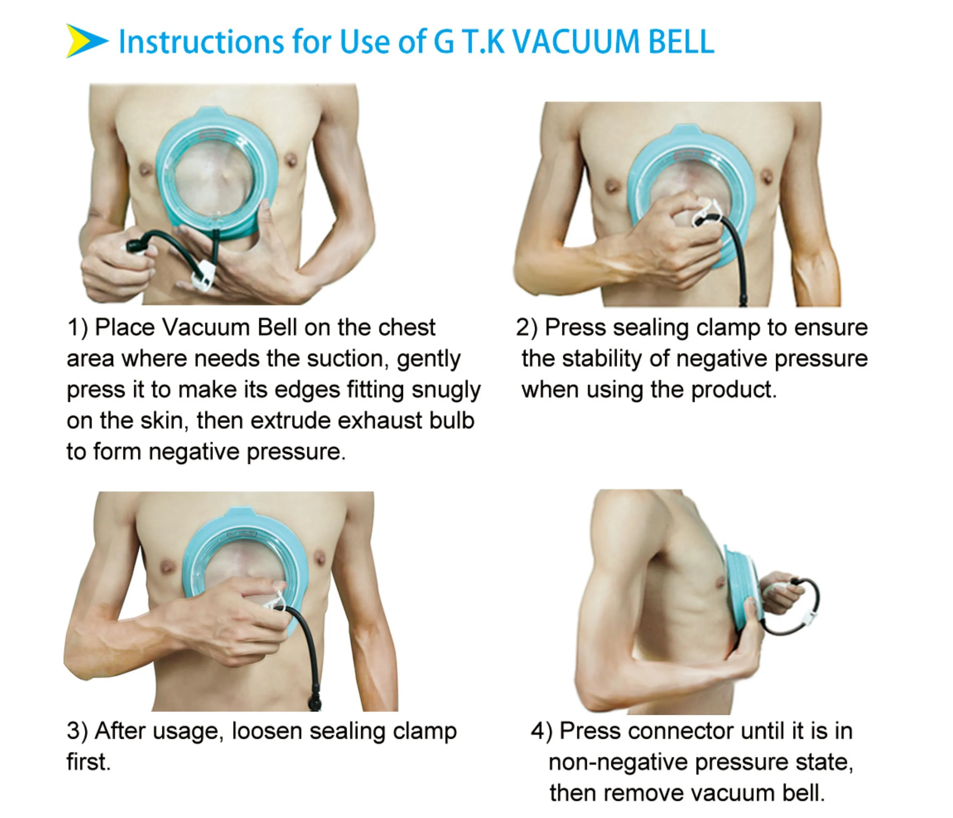 Vacuum Bell for Pectus Excavatum Treatment - Manual Device for Sunken ...