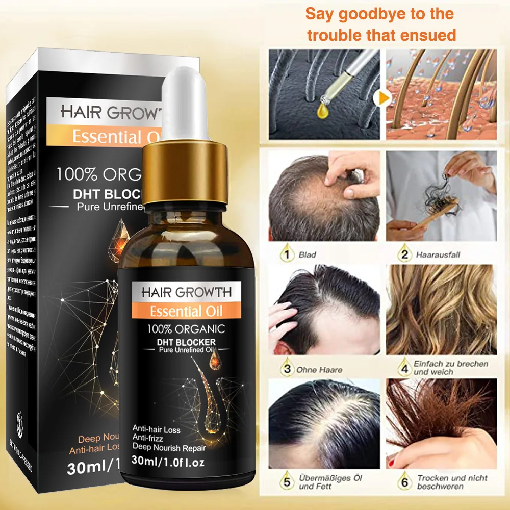 Custom Logo Private Label All Natural Formula Hair Growth Oil Serum Nourishing Scalp Rapid Hair Thickening Oil Organic Hair Oil