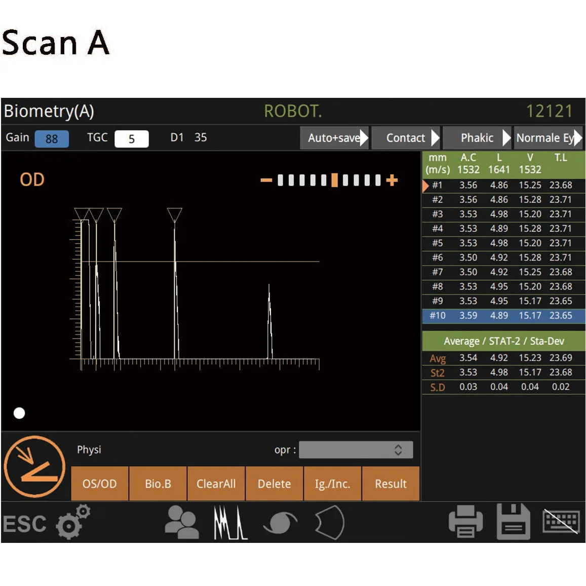 Hot Sale Hospital Medical Laptop Handheld Full Digital Portable Ophthalmic A/B Ultrasound Scanner