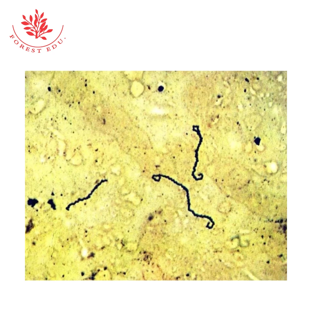 Spirochetes Bacteria Leptospira Hook Medical Microbiological Etiology ...