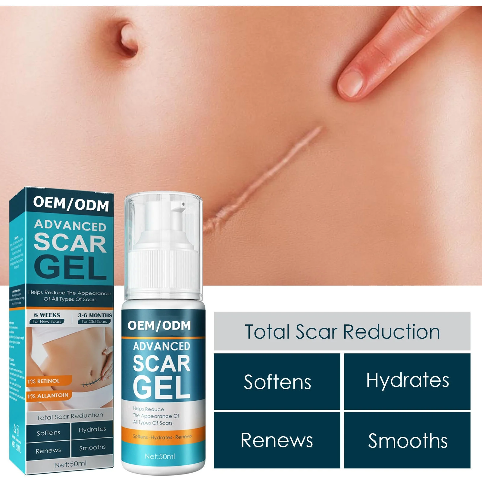 Wholesale Scar Gels for Beauty & Personal Care Lightening Acne Marks Removing Surgical Scars Repairing Scars