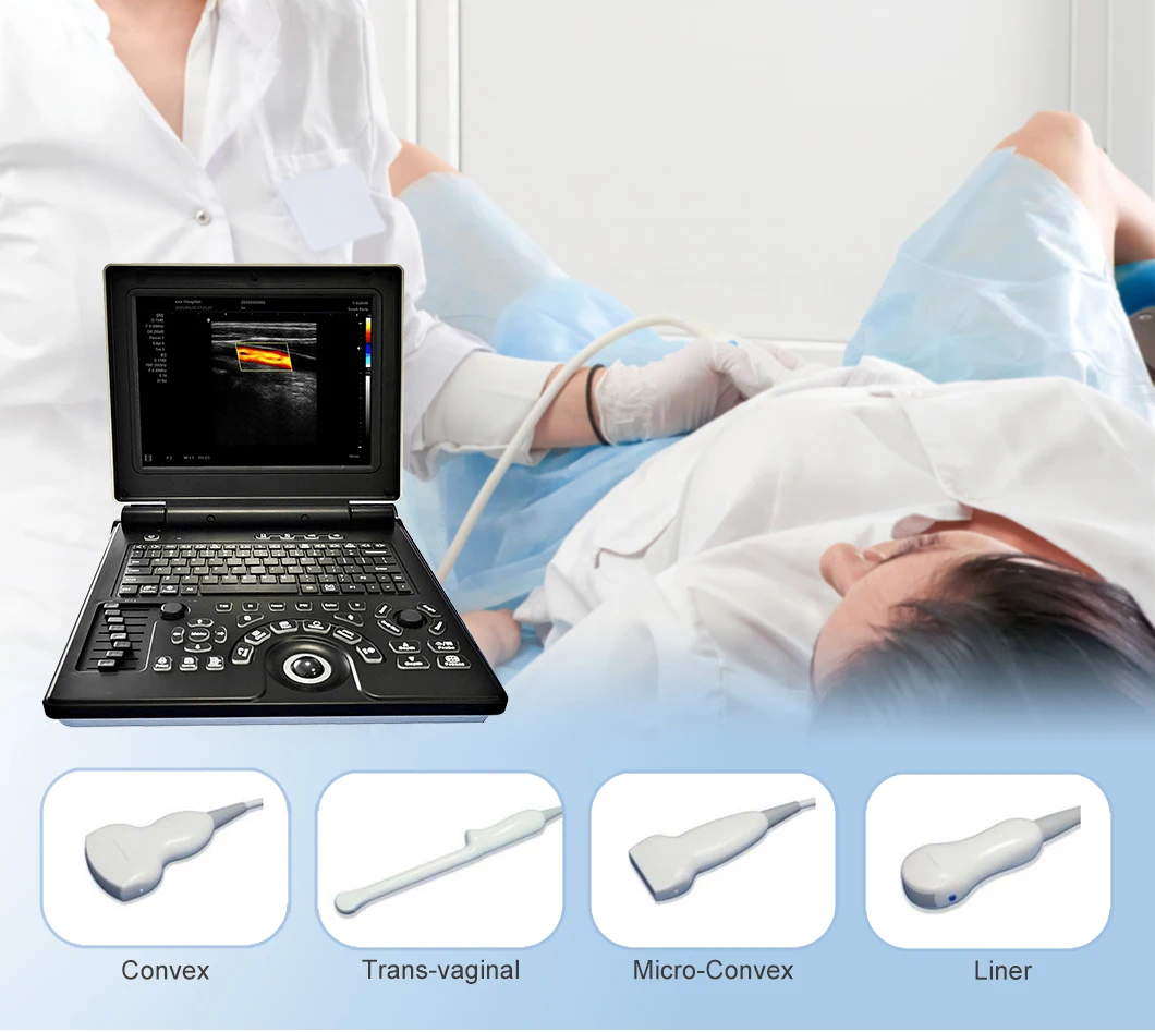 Full Digital Ultrasound Machine Medical Ultrasound Diagnostic System ...