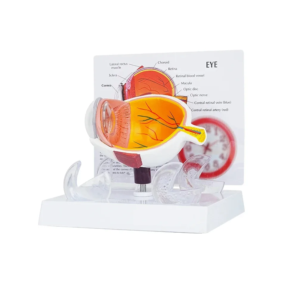 Ophthalmology Clinic Display Cornea Conditions Human Eye Demonstration Glaucoma Tool