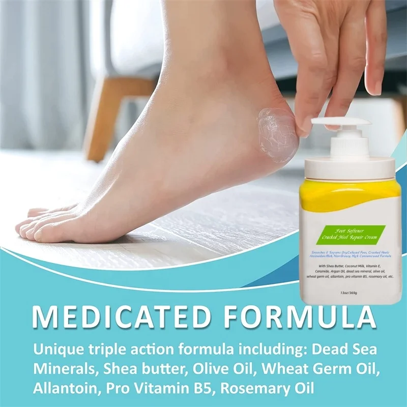 Amazon.com: Gold Bond Medicated Foot Powder and Foot Cream, Foot Creme, 4  oz : Beauty & Personal Care