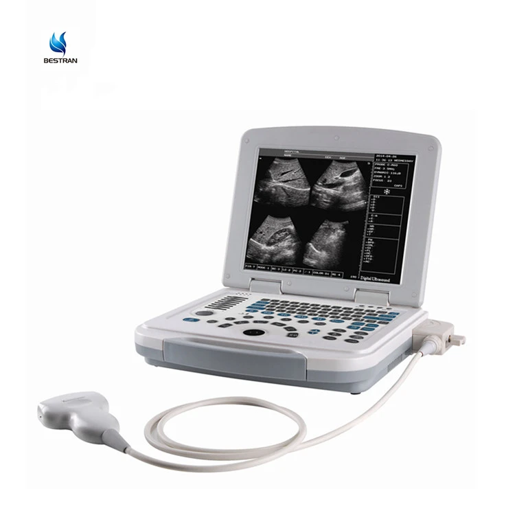 BT-UD580   Professional Medical Ultrasound Instruments CE and ISO Approved BW Handheld Doppler Ultrasound machine price-121058