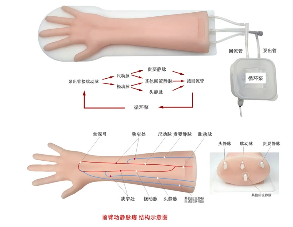 B-ultrasound Arteriovenous Fistula Training Model for Percutaneous Transluminal Angioplasty (PTA)