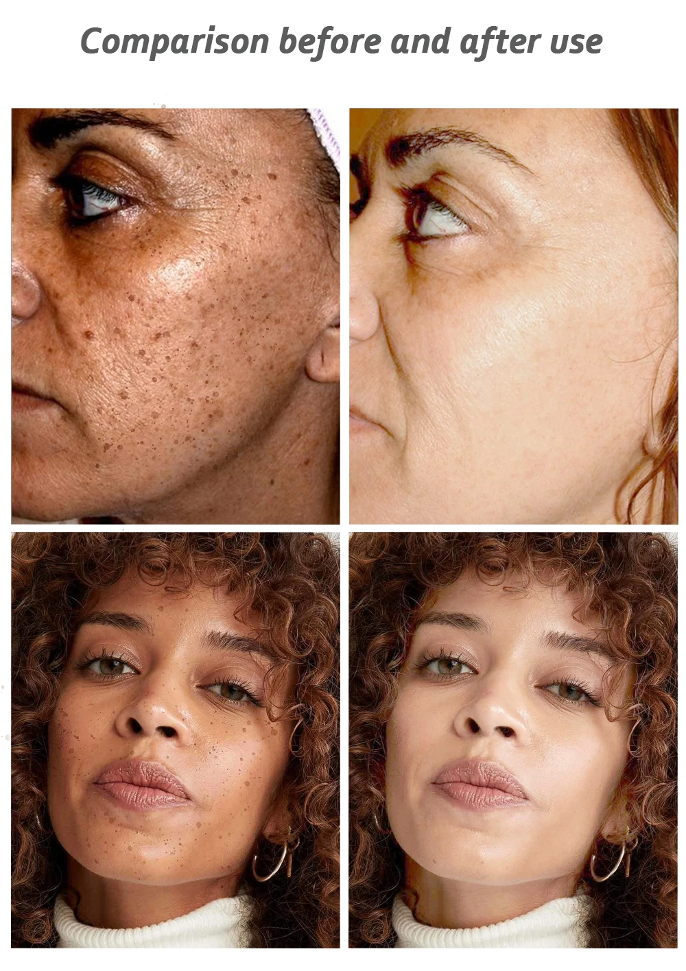 liposomal glutathione vs l-glutamine Glutathione Before and After Baltimore: Real Results
