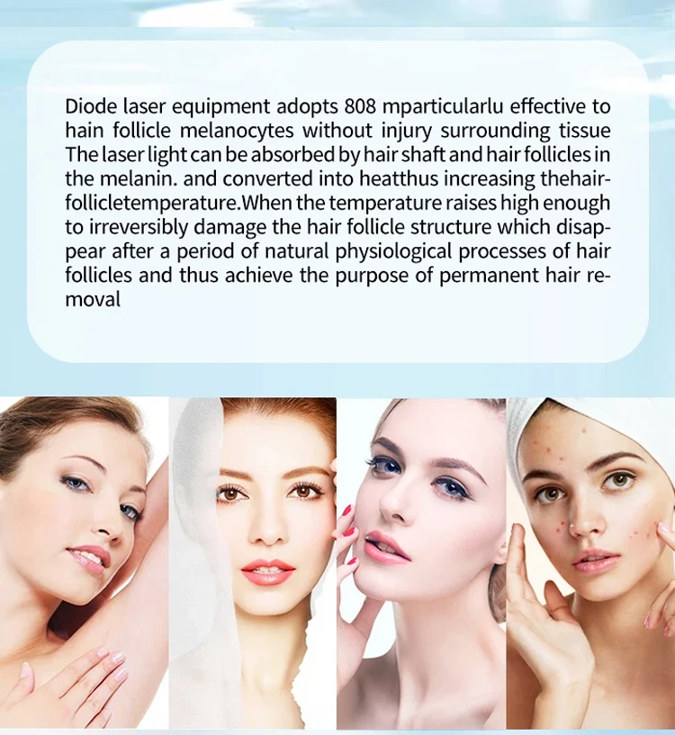 Good PriceLaser Hair Removal Machine Diode Laser  Best Feedback 2 In 1 1064nm Permanent Diode Laser Hair Removal  Machine