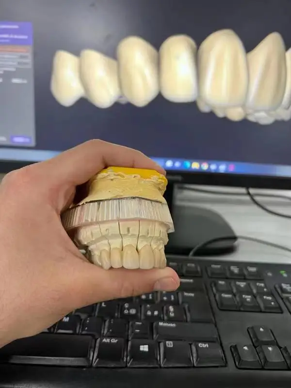 Yucera 4d Pro Multilayer Dental Zirconia Disc Ceramic for Lab for CE ISO for Full Arch Crown Bridge Long-Lasting