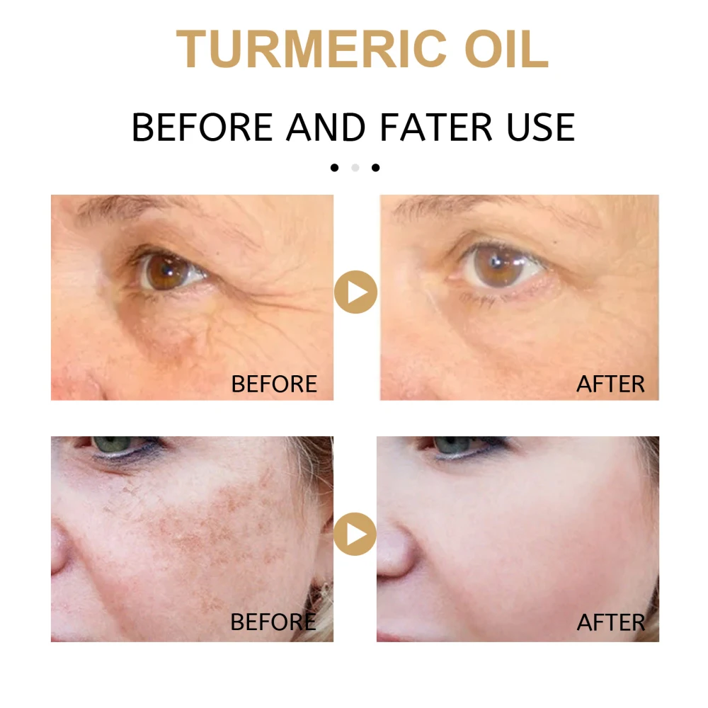 turmeric oil (2).jpg