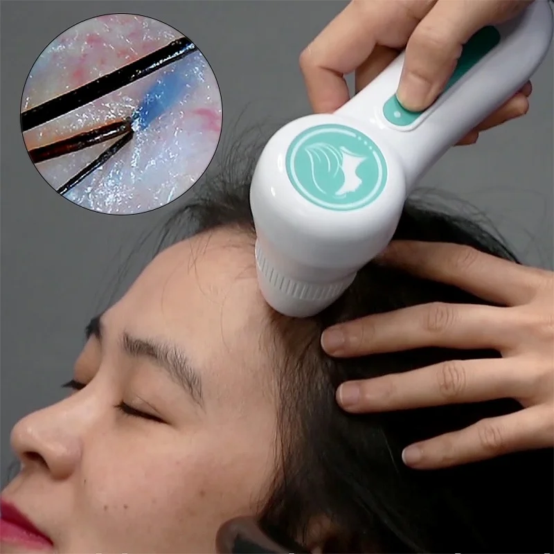 Portable 5-in-1 High Frequency Scalp Analyzer & HD Detector Ozone Therapy Hair Growth Massage Device for Salon & Home Use