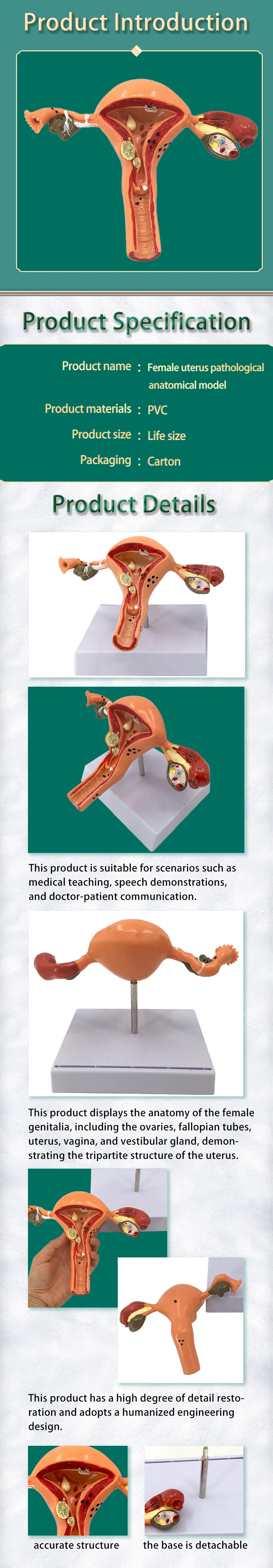 Human Anatomical Uterus Model - Displaying Fibroids & Tumors