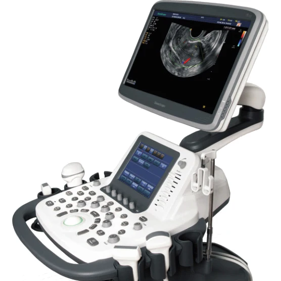 Sonoscape S22 Ultrasound Scanner - oxyaider