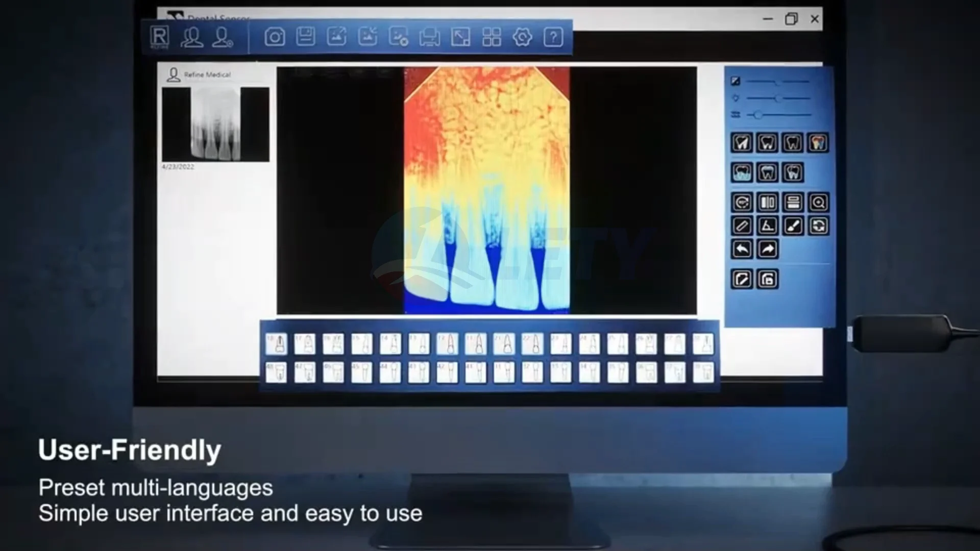 Cheapest Dental Sensor Digital Dental Xray Image System With Software