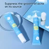 Salicylic acid acne gel